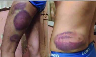 शराब कारोबारी के साथ पुलिसकर्मियों ने की जमकर मारपीट