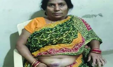 समस्या बताने पर BJP पार्षद के बेटों ने पीटा