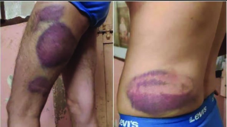 शराब कारोबारी के साथ पुलिसकर्मियों ने की जमकर मारपीट