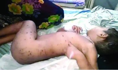 दो साल की बच्ची को उठा ले गए कुत्ते