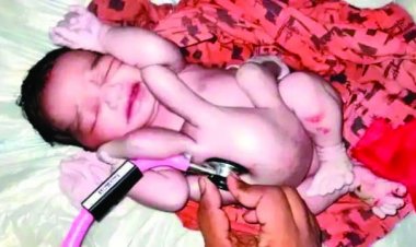   चार हाथ-चार पैर के साथ बच्चे का जन्म, लोग बोले- भगवान आ गए