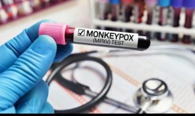 कंप्यूटर और माउस के इस्तेमाल से भी फैल सकता है मंकीपॉक्स