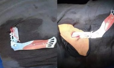 ट्रक चालक के पेट में चाकू घोप भाग निकले लुटेरे