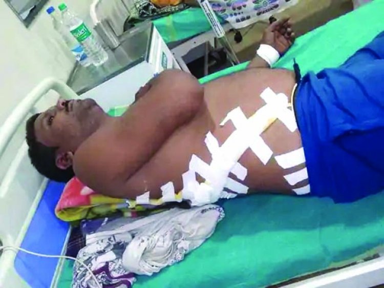 मोहल्ले के लड़के ने रास्ते में रोककर किया हमला, पुराने विवाद के चलते वारदात