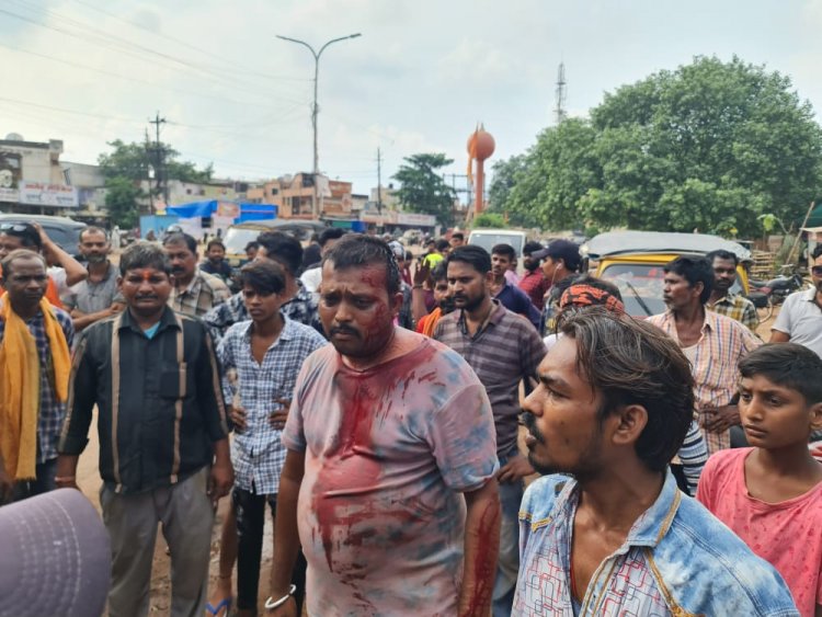 सुपेला में शराबी द्वारा लोगों को मारना पड़ा महंगा, पब्लिक ने इतनी कुटाई की कि शराबी को भर्ती होना पर अस्पताल में