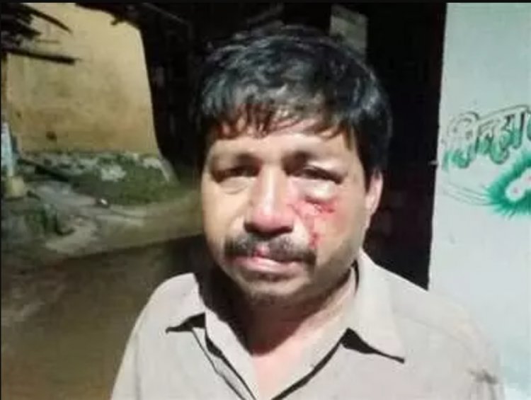 केसरा के उपसरपंच पर जानलेवा हमला