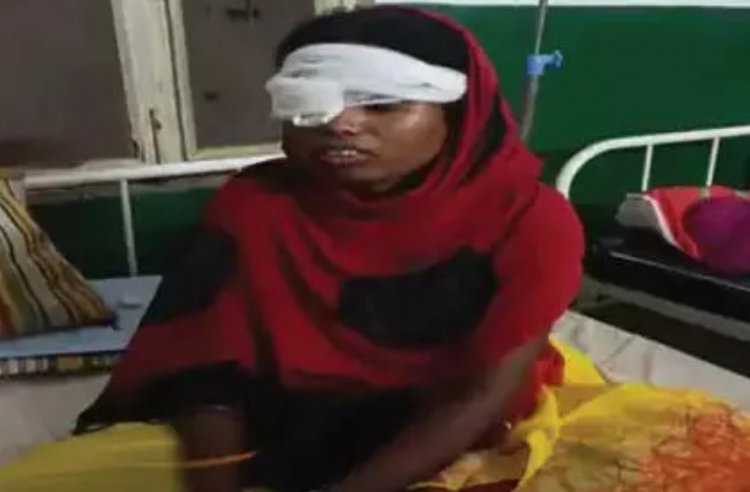 पत्नी की आंख फोड़ उंगली से निकाल दिया बाहर, फरार पति की सरगर्मी से तलाश जारी