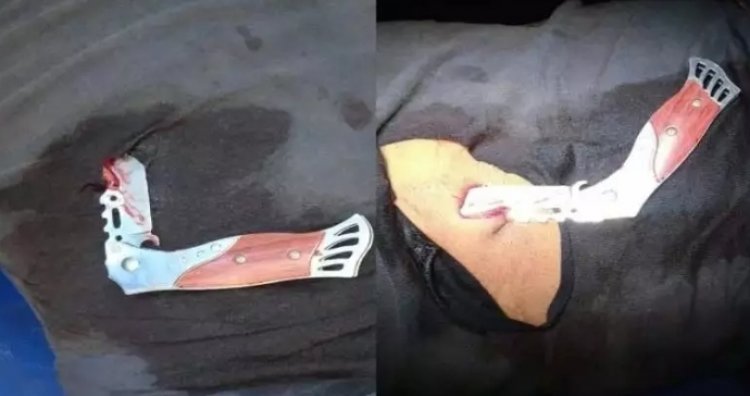 ट्रक चालक के पेट में चाकू घोप भाग निकले लुटेरे