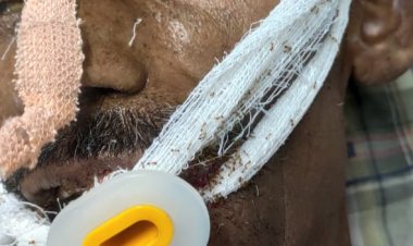 UPDATE: भिलाई के एक अस्पताल में भर्ती मरीज के शरीर में लगी चींटी, जानकारी मिलते ही पहुंचे डॉक्टरों ने किया साफ