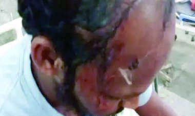 रंगदारी: सेंट्रल जेल में कैदी पर जानलेवा हमला