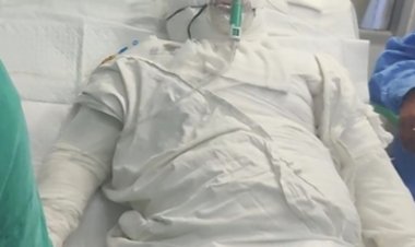 दुर्ग में रिटायर्ड टीआई की पत्नी ने आग लगाकर की आत्महत्या की कोशिाश, हालत गंभीर