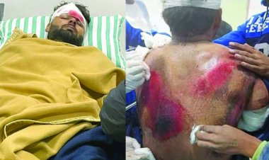 ऋषभ पंत हादसे के शिकार, कार में लगी आग, शीशा तोड़कर निकाला गया बाहर