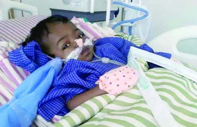 9 माह की बच्ची का लिवर ट्रांसप्लांट हुआ सफल