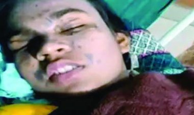 प्रैक्टिकल रूम की सफाई करने के दौरान हादसा, स्कूली छात्राओं पर गिरा तेजाब से भरा बॉटल