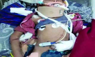 कोरर हादसे में घायल बच्चे की मौत