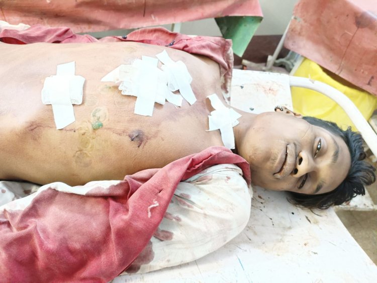 दुर्ग में दो भाइयों पर चाकू से जानलेवा हमला, एक की मौत दूसरा गंभीर, तीन सगे भाई गिरफ्तार