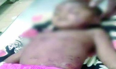 2 वर्षीय बच्चे को लकड़बग्घा ने बनाया अपना शिकार