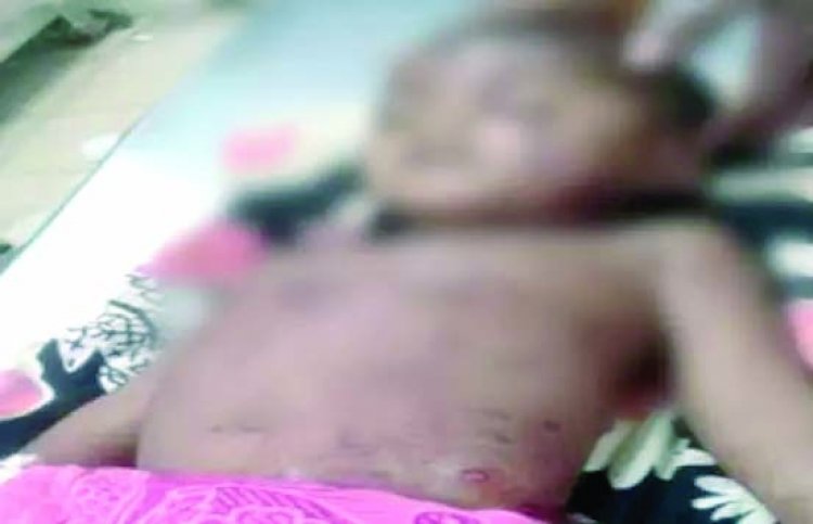 2 वर्षीय बच्चे को लकड़बग्घा ने बनाया अपना शिकार