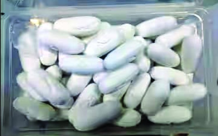 ब्राजील से आए यात्री के पेट से निकला 11 करोड़ का कोकीन, दिल्ली एयरपोर्ट पर पकड़ा गया