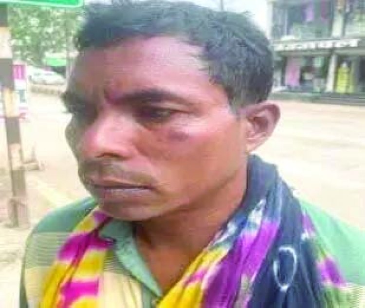 बकरी चोरी के आरोप में युवक से मारपीट, एसपी पल्लव से 4 पुलिसकर्मियों की शिकायत