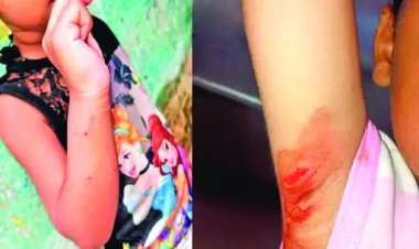 कुत्ते ने 4 बच्चों को नोचा, गुस्साए लोगों ने कुत्ते को मार डाला, उधर कुत्ते के मरने पर पहुंचे एनजीओ के लोगों के साथ बस्ती वालों का जमकर विवाद