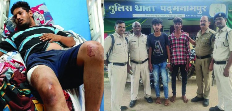 मधुबन बार के बाहर चाकूबाजी: दुर्ग पुलिस की कार्रवाई से परिजन असंतुष्ट, पुलिस अधीक्षक को सौंपा ज्ञापन