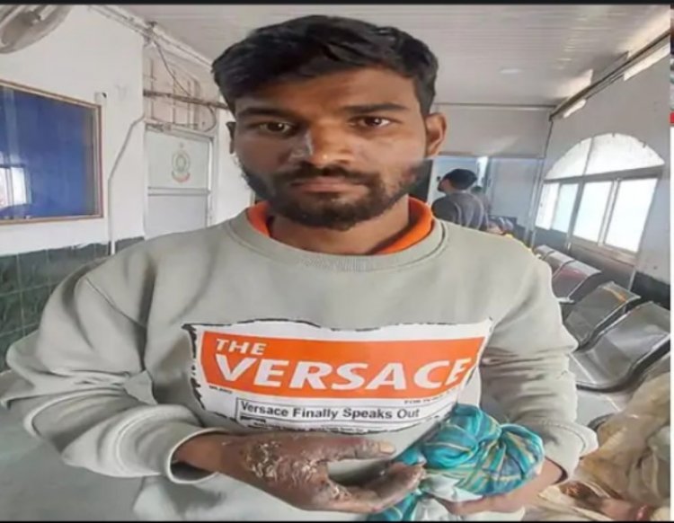 मिन्नी इंडस्ट्रीयल यूनिट के मालिक के खिलाफ अपराध दर्ज, कार्य के दौरान मशीन में फंस कट गई थी युवक की अंगुली, नहीं मिला कोई सहयोग
