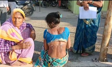 महिला पर डाला खौलता हुआ पानी, जेठ और जेठानी पर अपराध दर्ज