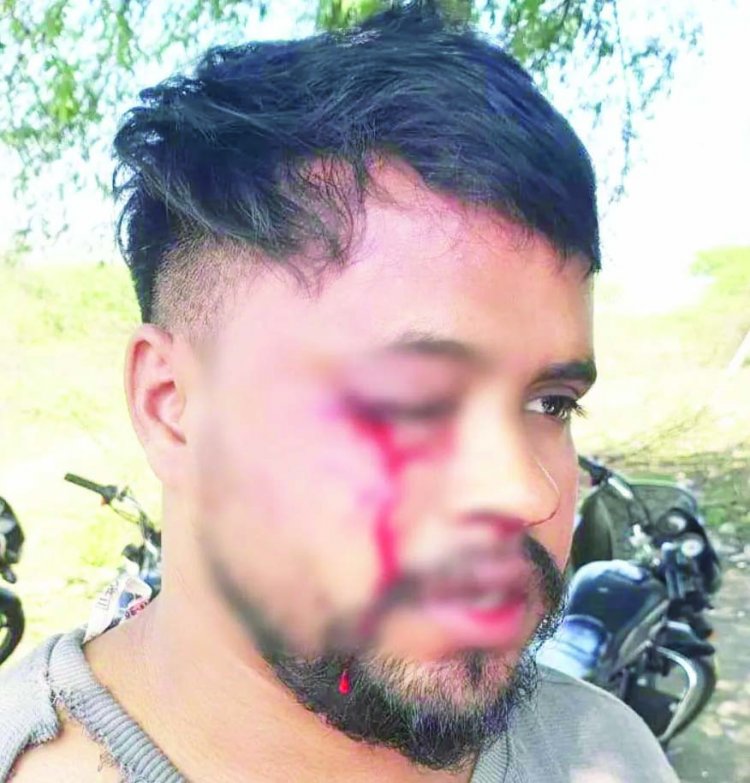 शराब कोच्चिया की दबंगई, सेल्समैन का फोड़ा आंख
