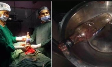 खुजलाते व्यक्त मल द्वार से युवक के पेट में घुस गई शराब की बोतल