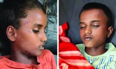 आकाशीय बिजली गिरने से दो सगे भाईयों की मौत