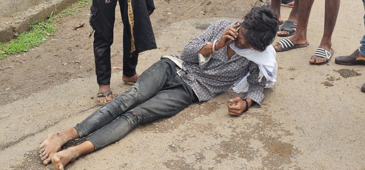 सड़क पर स्टंट करना पड़ा महंगा, युवक पैर हुआ फैक्चर