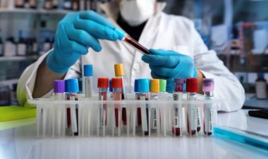 शोध में खुलासा, भारत के कई ब्रांडेड नमक और चीनी में माइक्रोप्लास्टिक, कैंसर का खतरा