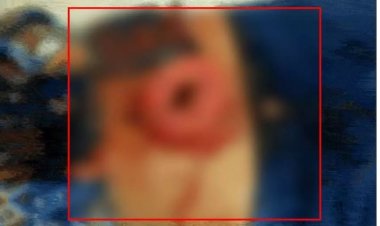 युवतियों से छेड़छाड़ और गाड़ी की चाबी छिनने को लेकर चाकूबाजी, आंतें बाहर निकल गई