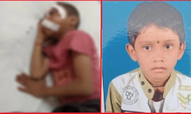 गंभीर हालत में मिला स्कूल के लिए निकला बालक, चोट के कई निशान, एक आंख फोड़ गोंद डालने का प्रयास, हालात नाजुक