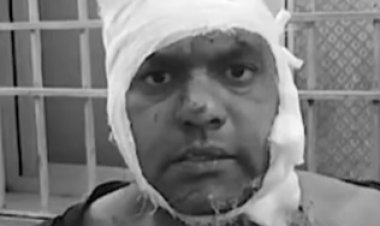 दुर्ग जिले में बदमाशों के हौसले बुलंद, CISF के इस रिटायर्ड जवान पर जानलेवा हमला, लाइसेंसी बंदूक के कारण बची जान