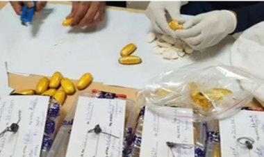 इस महिला के पेट से निकाला गया साढ़े 5 करोड़ का कोकीन, जांच के दौरान एयरपोर्ट में पकड़ी गई
