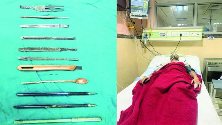 चौंकाने वाला मामला, इस मरीज के पेट से डॉक्टरों ने निकाला सूई ,छुरी, पेन