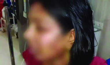 250 रुपए के लिए पत्नी के ऊपर पति ने फेंका खौलता हुआ गर्म दाल