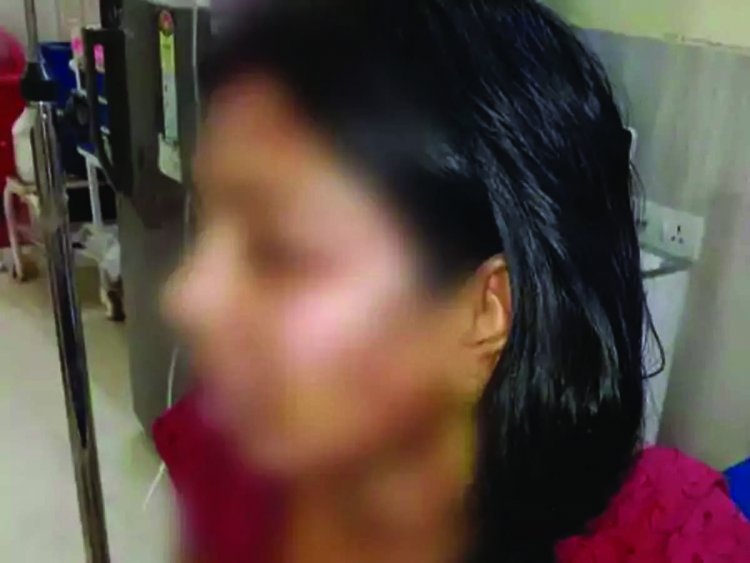 250 रुपए के लिए पत्नी के ऊपर पति ने फेंका खौलता हुआ गर्म दाल