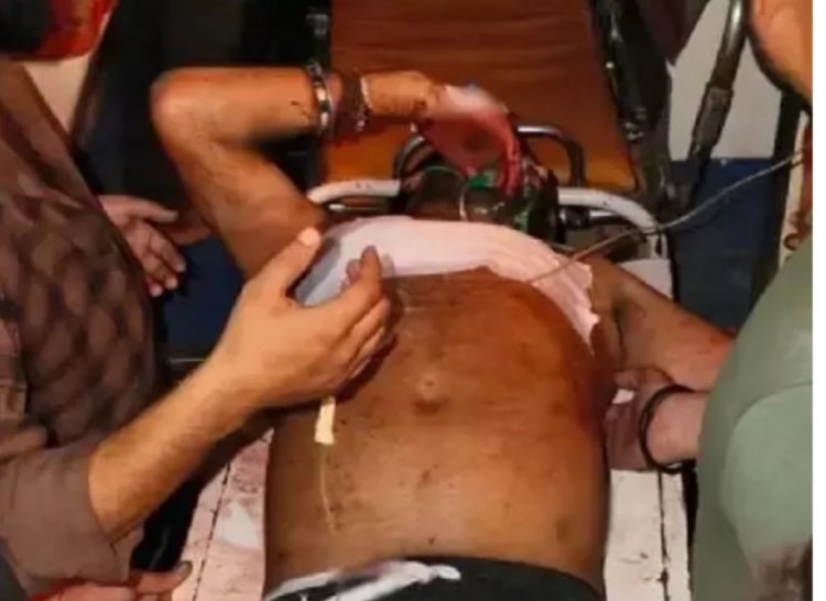 सैलून में 2 दोस्तों पर चाकू से हमला