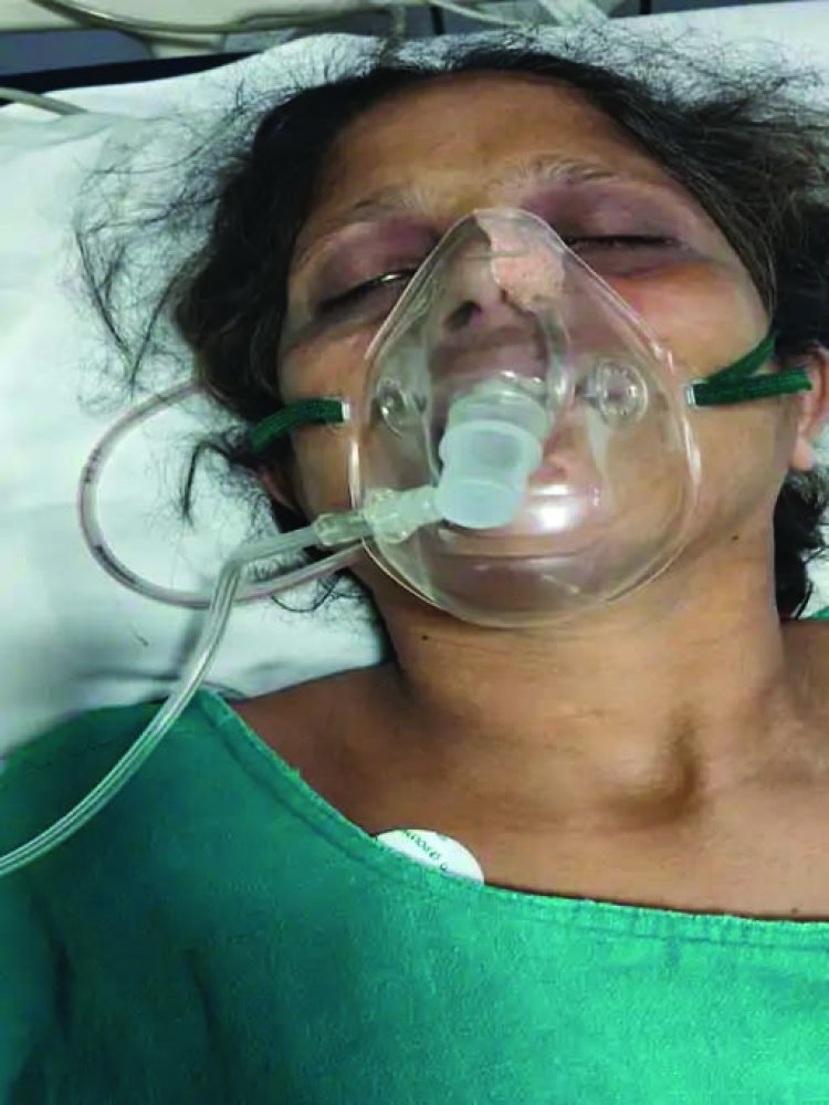 केमिकल फैक्ट्री में मजदूरों पर ऊपर से गिरा 1000 किलो वजनी बोरा, एक महिला की मौत, दो मजदूर घायल