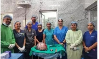 20 किलो का ट्यूमर लिए जी रही थी महिला, सर्जरी ने दी नई ज़िंदगी