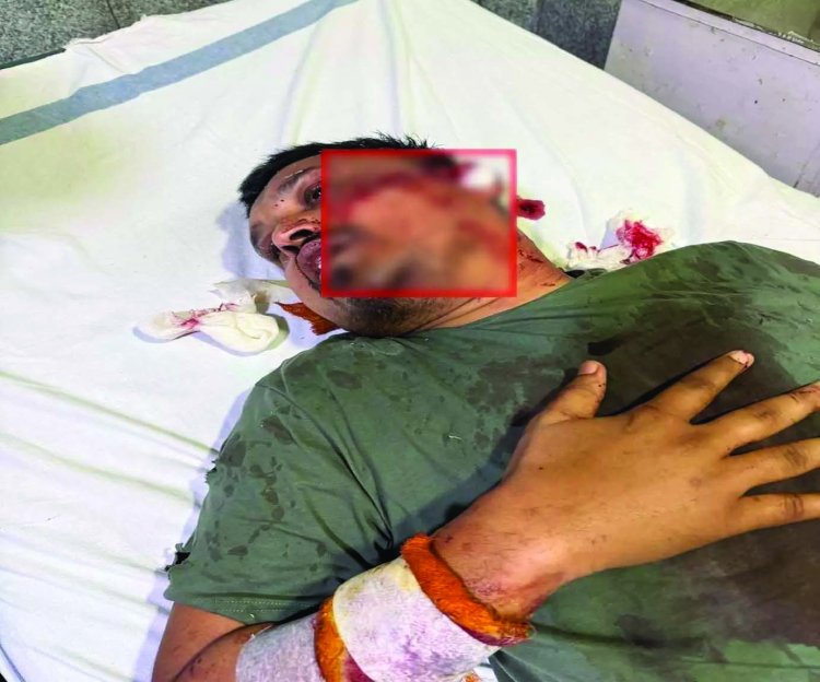 रायपुर सेंट्रल जेल में गैंगवार: भूपेश बघेल के करीबी नेता पर जानलेवा हमला, कांग्रेस में गुटबाजी उजागर
