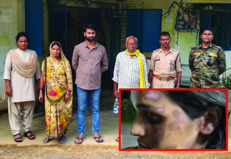 घरेलू हिंसा की हदें पार: महिला को बंधक बनाकर गर्म चिमटे से जलाया, मोबाइल पर चैटिंग के शक में पत्नी को तंदूर बना दिया