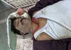 भिलाई में बड़ा हादसा, रेड सिग्नल पर खड़ी बाइकों को तेज रफ्तार कार ने रौंदा, 2 की मौत, एक युवक ICU में भर्ती, कार चालक पुलिस की गिरफ्त में
