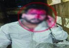 रायपुर में गैंगवार: दो गुटों के बीच चाकूबाजी और मारपीट, युवक गंभीर घायल
